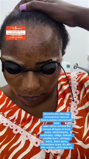 #tiktoksudan🇸🇩 #kampala_uganda🇺🇬🇺🇬🤝 #viralvideotiktok #alienskinug #permanentmakeup #trending