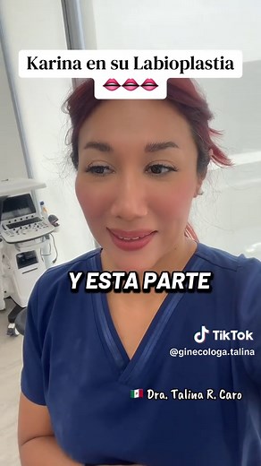 Labioplastia: La Transformación de Karina