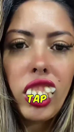 Grinding Your Teeth at Night? This Is What It’s Secretly Doing to Your Smile