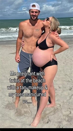 Can we normalize not being all glammed up at the beach🙏🏻 bc us mamas are tiiireed.🥱😅 And do you see his little hand on my leg🥹 It’s so funny bc younger me wouldn’t be caught de@d at the beach with hairy legs, no tan, and gnarly toenails but now all I think about is how much fun my kids will have and we are off!☀️🏖️ It’s amazing how kids humble ya REAL FAST!💯🤪🤗 Becoming a mommy has truly helped me focus on what’s most important…one day I’ll have a tan, smooth skin and perfectly polished 