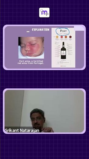 Port Wine Stain Explained | Vascular Malformation | NEET MDS | NEXT | INICET