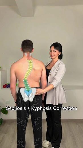 Can scoliosis be addressed with an individual approach? In this video I demonstrate a fragment of correction using my Asymmetric Method. Each patient has a unique scoliosis pattern, muscle imbalance, pelvic position and spinal rotation. That is why I do not use the same exercises for everyone. My method focuses on: ✔ Individual adaptation ✔ Asymmetric correction ✔ Pelvic alignment ✔ Spinal elongation ✔ Deep stabilizer activation ✔ Neuromuscular re-education This is a fragment of a rehabilitation