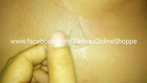 YELLOW PEELING OIL (YPO) stronger formula compared to GPO. (For first...