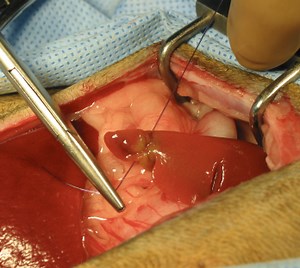 Exploratory Laparotomy - Focus and Flourish