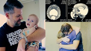 272K views · 13K reactions | A Florida family has received an anonymous donation to help treat their child's rare brain condition. Millie was born with alobar holoprosencephaly. The disorder causes the fetal brain to not properly separate into the right and left hemispheres, according to the Cleveland Clinic. Treatments cost over $40,000, which an anonymous donor gifted Millie so she could continue her life-saving treatment. | Inside Edition | Facebook