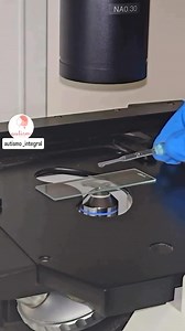 Así se vén los parásitos con el protocolo con clavo de olor | Deo Olms