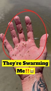 For those who say Sand Piranhas don’t actually bite/hurt watch this whole video! #animals #nature #sandpiranhas | Jacob Colvin