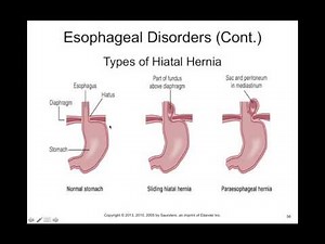 Chapter 36 Gastrointestinal Disorders BIOL300