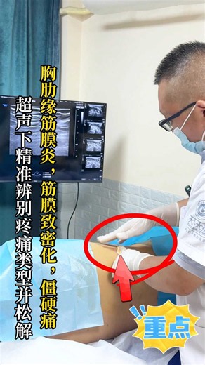胸肋缘筋膜炎，筋膜致密化，僵硬痛，超声下精准辨别并治疗