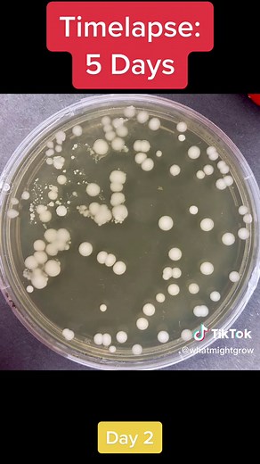 Food Science Experiment: Testing Microbial Growth in a Food Item