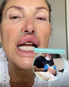 357K views · 1.2K reactions | My lip flip gone horribly wrong | Ultimate | Facebook