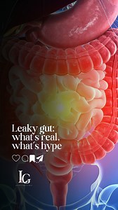 “Leaky gut” is one of the most misunderstood topics in gut health. Some parts are real. Some parts are marketing. Here’s a clear, evidence-based explanation of what actually happens and how you can support your gut without extreme diets, detoxes or expensive supplements. If you’d like guidance on improving your gut symptoms safely, book an appointment with us. #LeakyGut #DigestiveHealth #GutHealthFacts IBS NutritionEducation GutHealingJourney | LG Nutrition Clinic