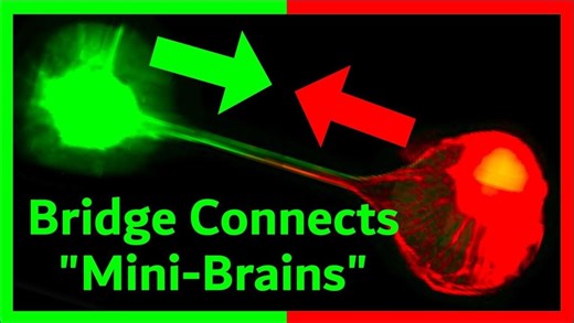 Brain Organoids Communicate: A Step Toward “Organoid Intelligence” – Lifeboat News: The Blog