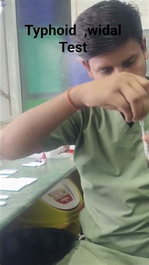 typhoid, widal test in serology lab 💉