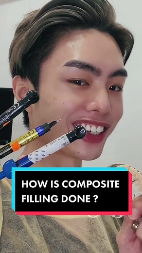 Composite Filling Work Flow #learnontiktok #tiktokguru #edutok #dentist #dental #dentalstudent #fyp