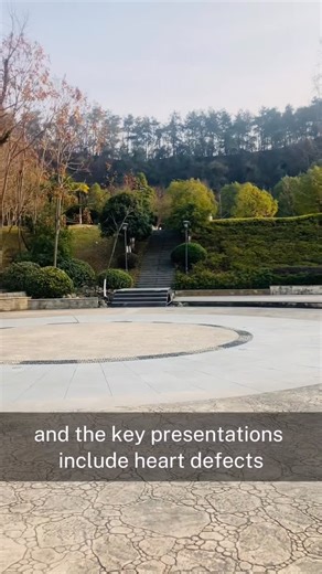 ASAD KHAN on Instagram: "DiGeorge Syndrome (22q11.2 Deletion Syndrome) A genetic microdeletion syndrome causing **defects in structures derived from the 3rd and 4th pharyngeal pouches**. * **Main Cause:** **Microdeletion at chromosome 22q11.2** (autosomal dominant). * **Key Presentations (CATCH-22):** * **C**ardiac defects (Tetralogy of Fallot, truncus arteriosus) * **A**bnormal facies * **T**hymic aplasia → **T-cell deficiency** (recurrent viral/fungal infections) * **C**left palate * **H**ypoc