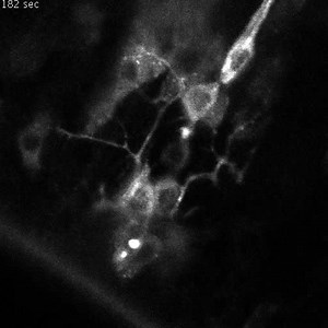 File:Development-of-dendrite-polarity-in-Drosophila-neurons-1749-8104-7-34-S3.ogv - Wikimedia Commons