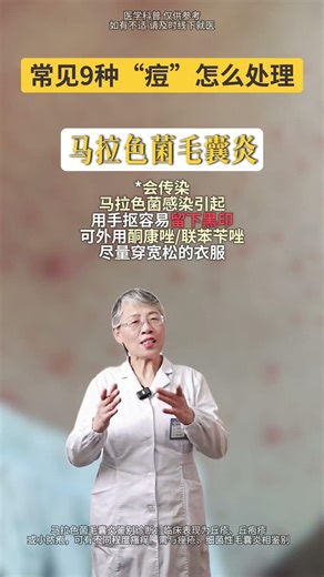 医生教你正确处理身上常见9种”痘“ #医生 #科普 #知识渊博 #科普一下