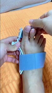 How to Correct Toe Deformity at Home ( # 2115 ) 1️⃣ Adjustable Foot Care Big Toe Straightener