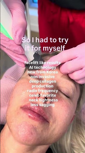 Non surgical facelift 👀👏