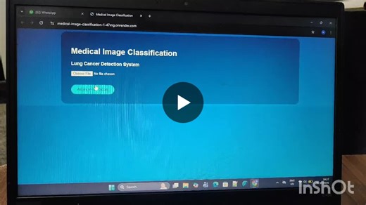 Medical Image Classification for Lung Cancer Detection with Python and TensorFlow | Nerusu Thanuja posted on the topic | LinkedIn