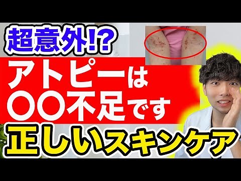 Characteristics of people whose atopic dermatitis is not cured （What is skin care by doctors? ）