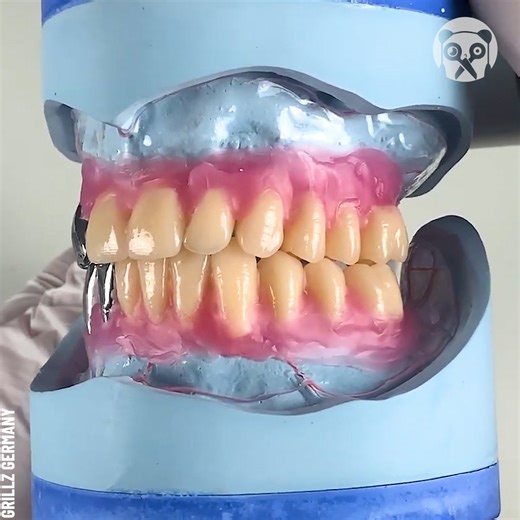 The process of making dentures with metal teeth Partner: Grillz Germany YT: https://www.youtube.com/channel/UCc2yaftWSq_dPdMWuMOfjFw | Genius Panda