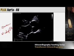 Lecture 3 - Transthoracic Echocardiography Part 2