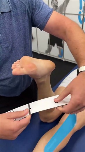 Taping For Plantar Fasciitis.