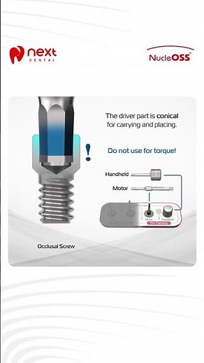 Complete Guide to Hex Drivers in Dental Implantology |Proper Usage for Carrying &Torquing Components