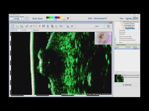 DUB SkinScanner Software 1