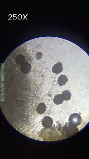 Bread mold (Rhizopus stoloni ) #breadmold #bread #microscope #spores #fungilovers #tinyecosystems