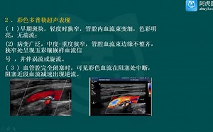 2021阿虎医考正高副高主任医师2021超声医学技术副主任技师头颈和四肢考试大纲 考试视频免费下载 题库 课程 讲解 考试辅导 资料 视频培训 教学讲座课件_哔哩哔哩_bilibili