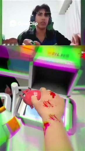 Cirugía Desastrosa ¡El Corazón de Juanito Se Cayó! #clips #fortnite #mariokart #shorts #nintendo