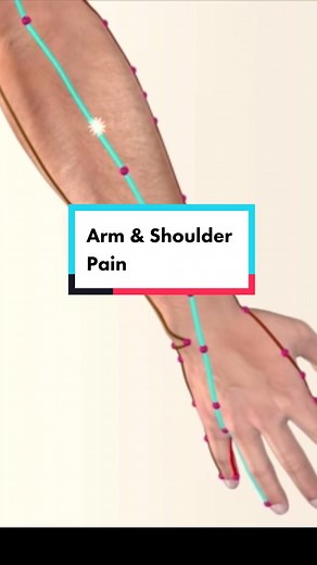 San Jiao Meridian Acupuncture Points for Pain Relief