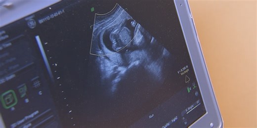 UnityPoint Health - Meriter using screening initiative to combat pregnancy-related deaths