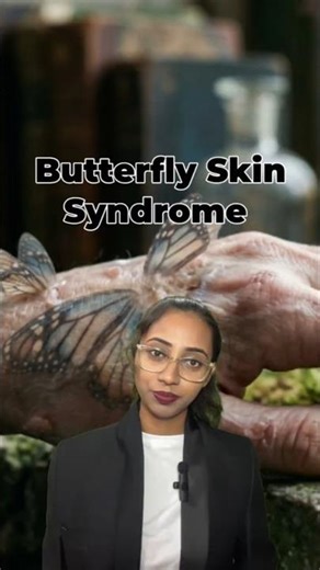 Fragile beyond belief | Butterfly Skin Syndrome