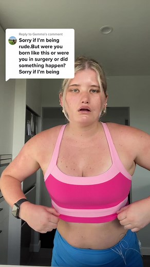 Replying to @Gemma i was born with a rare syndrome called Moebius Syndrome 🫶🏼💕 #moebiussyndrome #moebius #smilesurgery