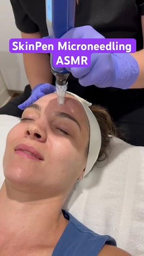 SkinPen Microneedling in Houston, TX - ASMR