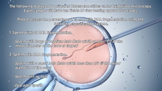 EQASRM Halo Sperm Dist 1 25-26