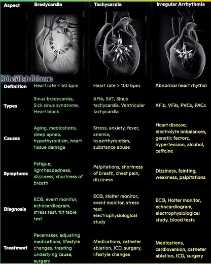 ⚡Exploring Arrhythmias: Bradycardia, Tachycardia & Irregular Heartbeats. #Cardiology #Arrhythmia #Bradycardia #Tachycardia #HeartHealth #CardiovascularDisease #MedicalProfessionals #CardiologyInsights #HeartRhythm #MedicalEducation #CardiologyEducation #CardiologyAwareness #CardiologyFellows | Abdallah Othman
