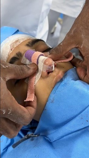 Nose Packing and Nasal splint after rhinoplasty