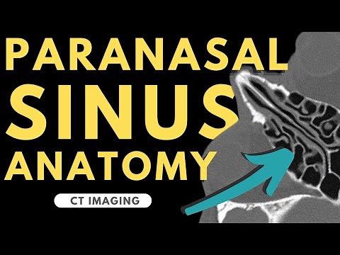 Paranasal Sinuses and Nasal Cavity | Radiology anatomy part 1 prep | CT imaging