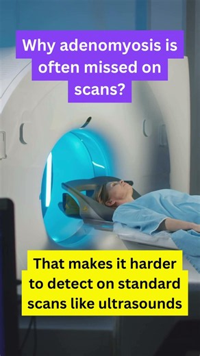 Why is adenomyosis often missed on scans? #adenomyosis #diagnosis