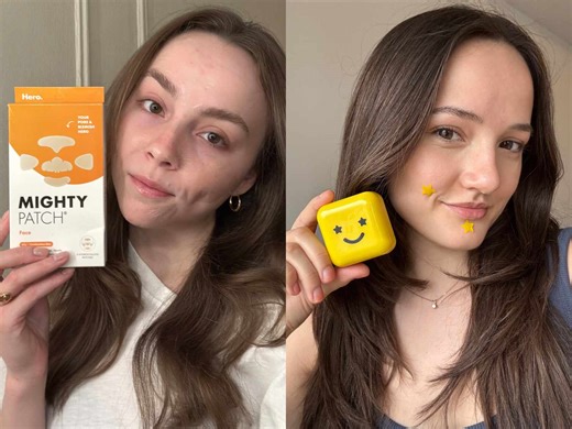 I Tried the Internet's Most Beloved Pimple Patches—Here Are the Only Ones I Reach for When I'm Desperate for Overnight Results