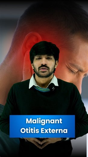 DrSubodh Chaturvedi on Instagram: "Ear Discharge in a Diabetic is a Red Flag! 🚩 We often think of Mucormycosis first, but there is another severe infection lurking in uncontrolled diabetics. The Scenario: An elderly diabetic patient presents with severe ear pain (otalgia) and discharge (otorrhea). The Diagnosis: Always rule out Malignant Otitis Externa (also known as Necrotizing Otitis Externa). Why is it an emergency? It is not a simple skin infection. It is an osteomyelitis of the temporal bo