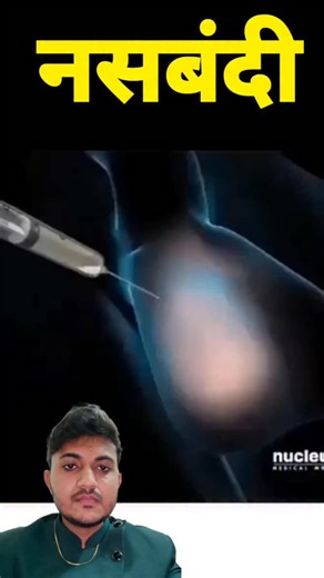 Yogesh Medicare YT on Instagram: "Nasbandi #vasectomy #nasbandi"