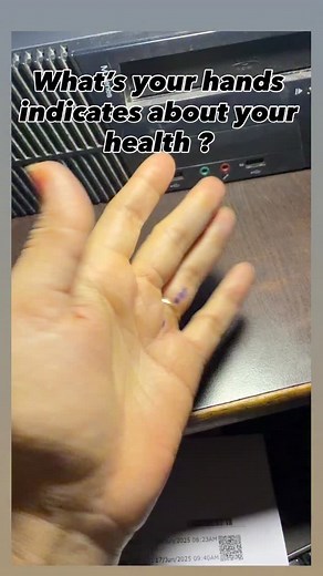 33K views · 135 reactions | 1. Dark Knuckles Possible causes: •...