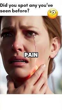 9 Silent Signs of High Cholesterol You Should Never Ignore！