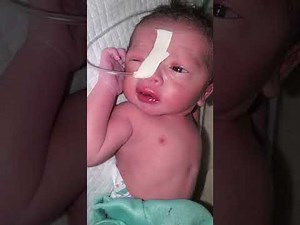 How to Use The Incubator Machine For Baby